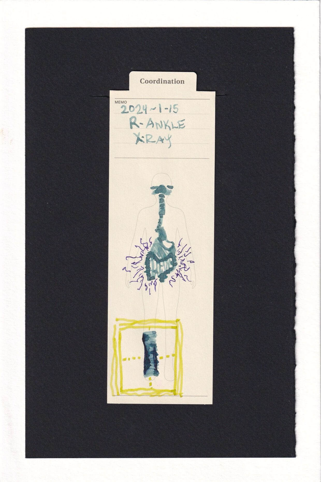 Similar to the previous bookmark, this one has a cool clinical blue-grey digestive track with dark large intestine/colon. purple thin squiggly sparks surround it. Over the right ankle, in neon yellow-green is an x-ray alignment grid. The ankle is wrapped in bandages. The nose and sinuses are dark as well.