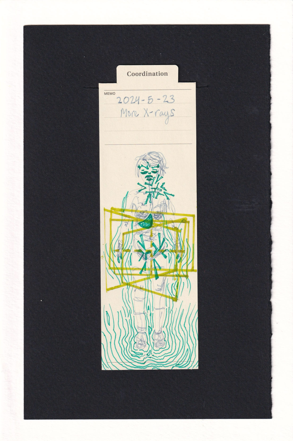 Figure adorned with grey, green, and toxic yellow lime ink. The yellow lime are a bunch of frames (4) at different perspectives surrounding the lower abdomen and hips, identifying x-ray locations. They are focused with hatched lines vertically and horizontally on the pelvis. The figure's lower legs are surrounded by radiating lines which resemble topographical swirls of pulsing. There are smaller amounts of these around the hips and arms as well. The stomach is full of green hatches, there are a bunch of green Vs in different angles within the x-ray frames and along the neck and left shoulder. The figure has worried eyebrows but the fave is reserved.